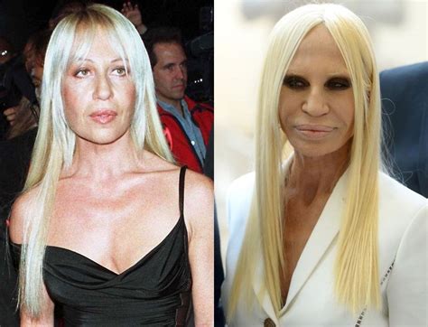 photo donatella versace|donatella versace before and after.